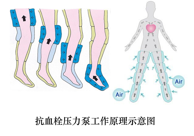 空气循环压力治疗仪